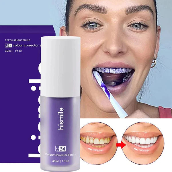 Blanqueador Dental V34